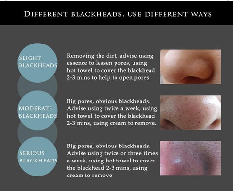 Image of Facial Blackhead Remover Mask