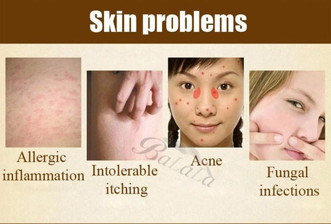 Image of Acne Treatment Control Soap