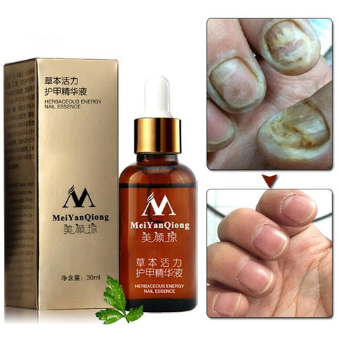 Image of Fungal Nail Essence Treatment Gel Anti Infection